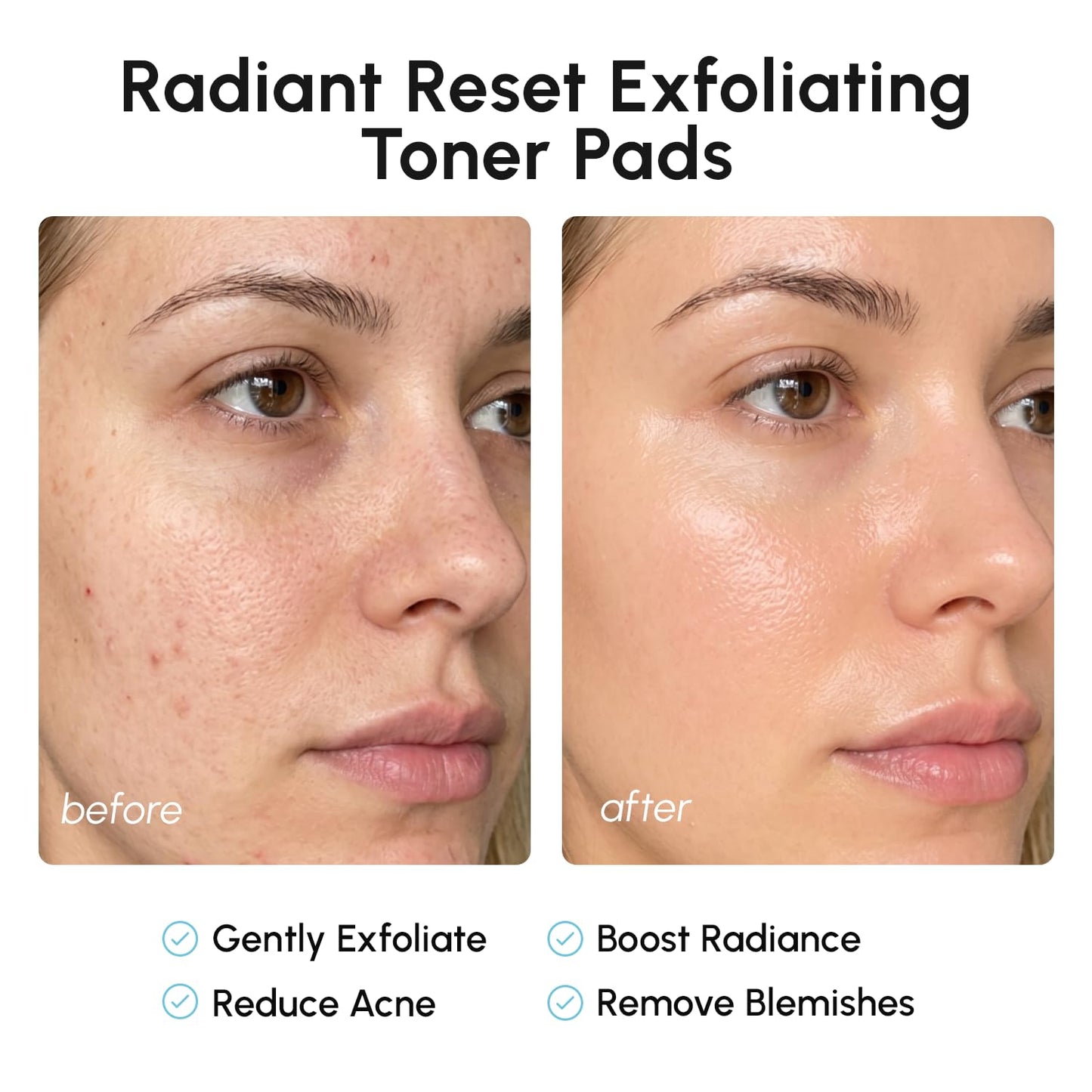 MAREE Glycolic Acid Pads - Toner Pads for Face Cleansing - Exfoliating Pad with Tea Tree Oil, Salicylic Acid & Vitamins E, B3, B5..