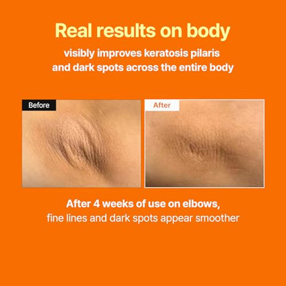 MEDITHERAPY The Glass Skin Booster Duo - Retinal Skin Booster Serum + Ultra Hydrating Acid Serum (K-Beauty Set)