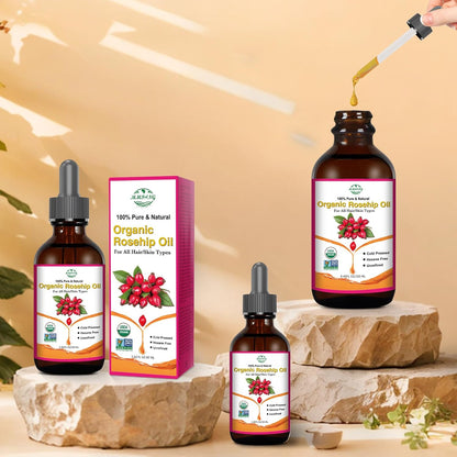 Organic Rosehip Oil for Face &amp; Skin – USDA Certified, Cold Pressed, Unrefined Rose Hip Seed Oil for Anti-Aging..