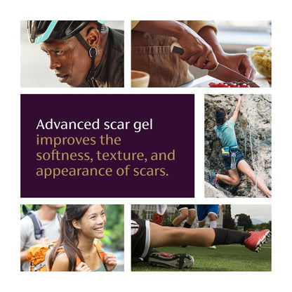 Mederma Advanced Scar Gel - Treats Old &amp; New Scars, Reduces Appearance of Scars from Acne..