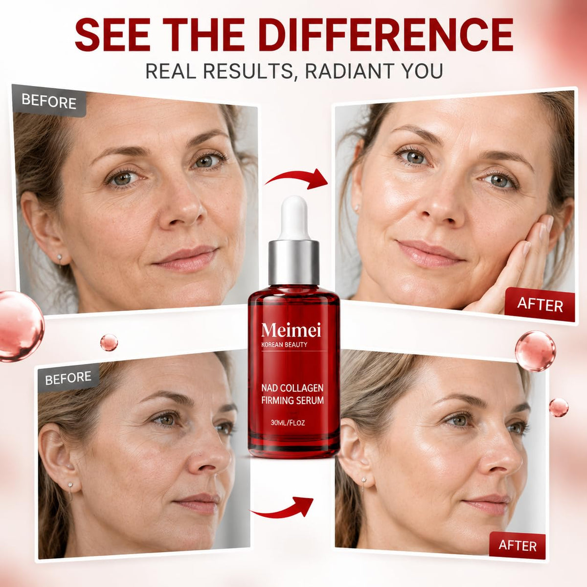 Meimei Korean Beauty Nad Firming Serum, Meimei Firming Serum