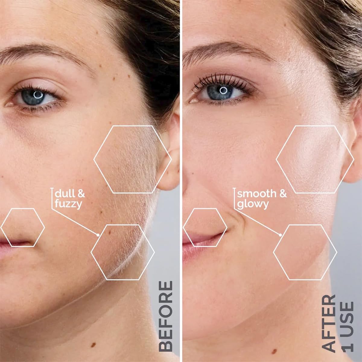 Michael Todd Beauty Sonicsmooth Dermaplane Razor for Women Face | Dermaplaning System + Eyebrow Trimmer, Peach Fuzz Remover...