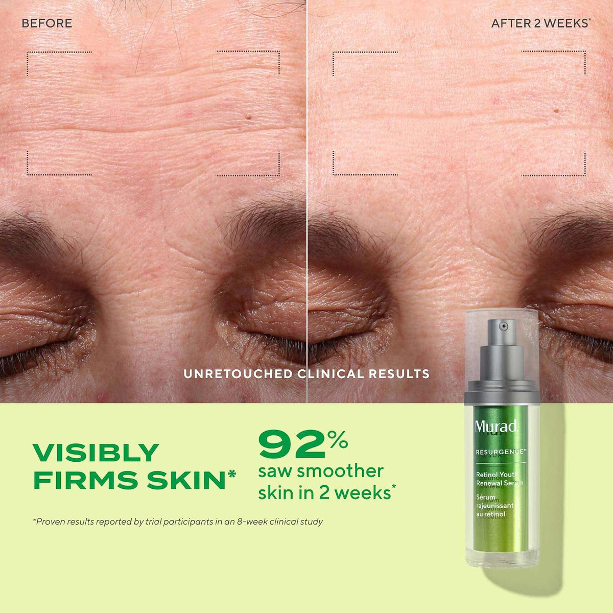 Murad Retinol Youth Renewal Serum - Retinol Face Serum