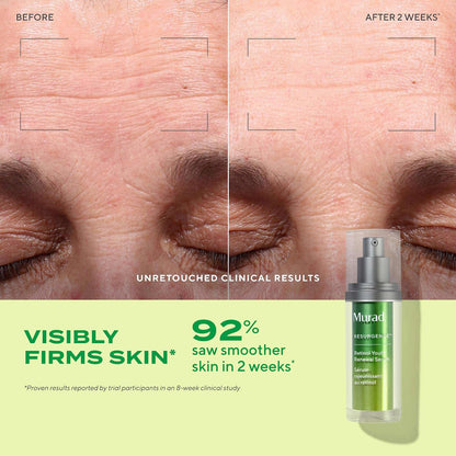 Murad Retinol Youth Renewal Serum - Retinol Face Serum