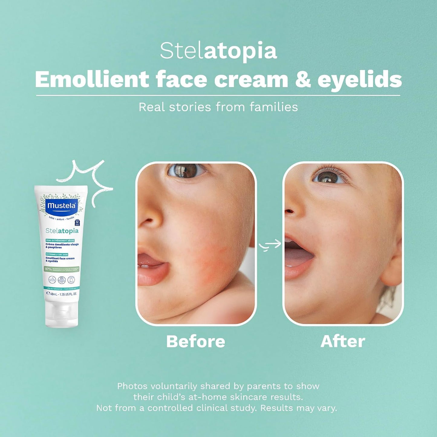 Mustela Stelatopia Eczema-Prone Skin Emollient Baby Face Cream - Face Moisturizer with Natural Avocado & Sunflower Oil..