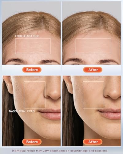 4D LED Red Light Therapy Mask for Face Skin Glowing