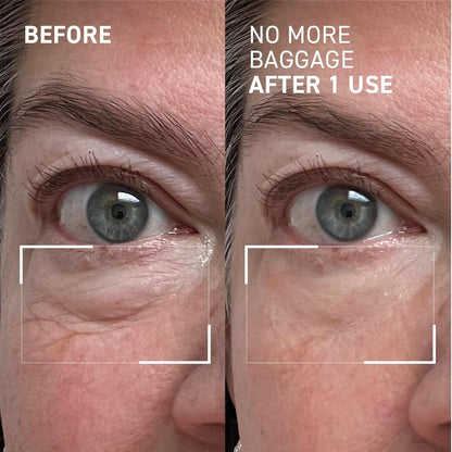 Dr. Brandt Needles No More, No More Baggage - Minimizes Under-Eye Bags, Puffiness & Dark Circles - 0.5 oz (Pack of 1)