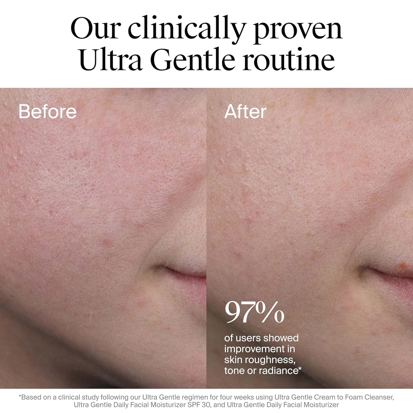 Neutrogena Ultra Gentle Daily Facial Moisturizer with SPF 30 Sunscreen with CICA, Lightweight Face Lotion..