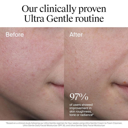 Neutrogena Ultra Gentle Daily Facial Moisturizer with SPF 30 Sunscreen with CICA, Lightweight Face Lotion..