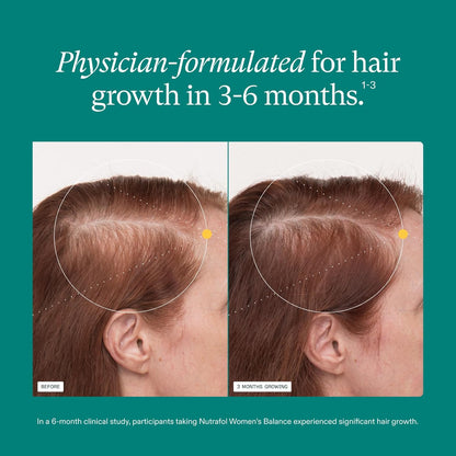 Nutrafol Women's Balance Hair Growth Supplements, Ages 45 and Up, Clinically Tested for Visibly Thicker Hair and Scalp Coverage..