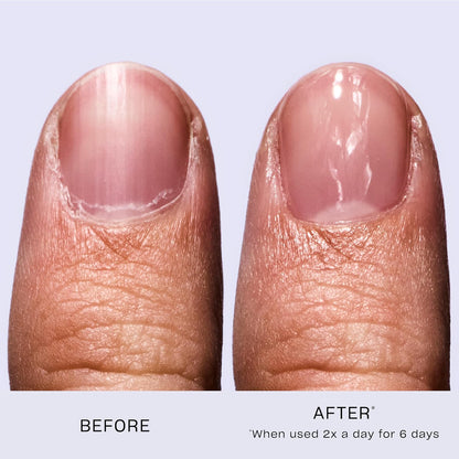 OPI Nail Envy Nail Strengthener | Clear & Opaque Nail Polish Treatment | Strengthen Weak & Thin Nails | Repair