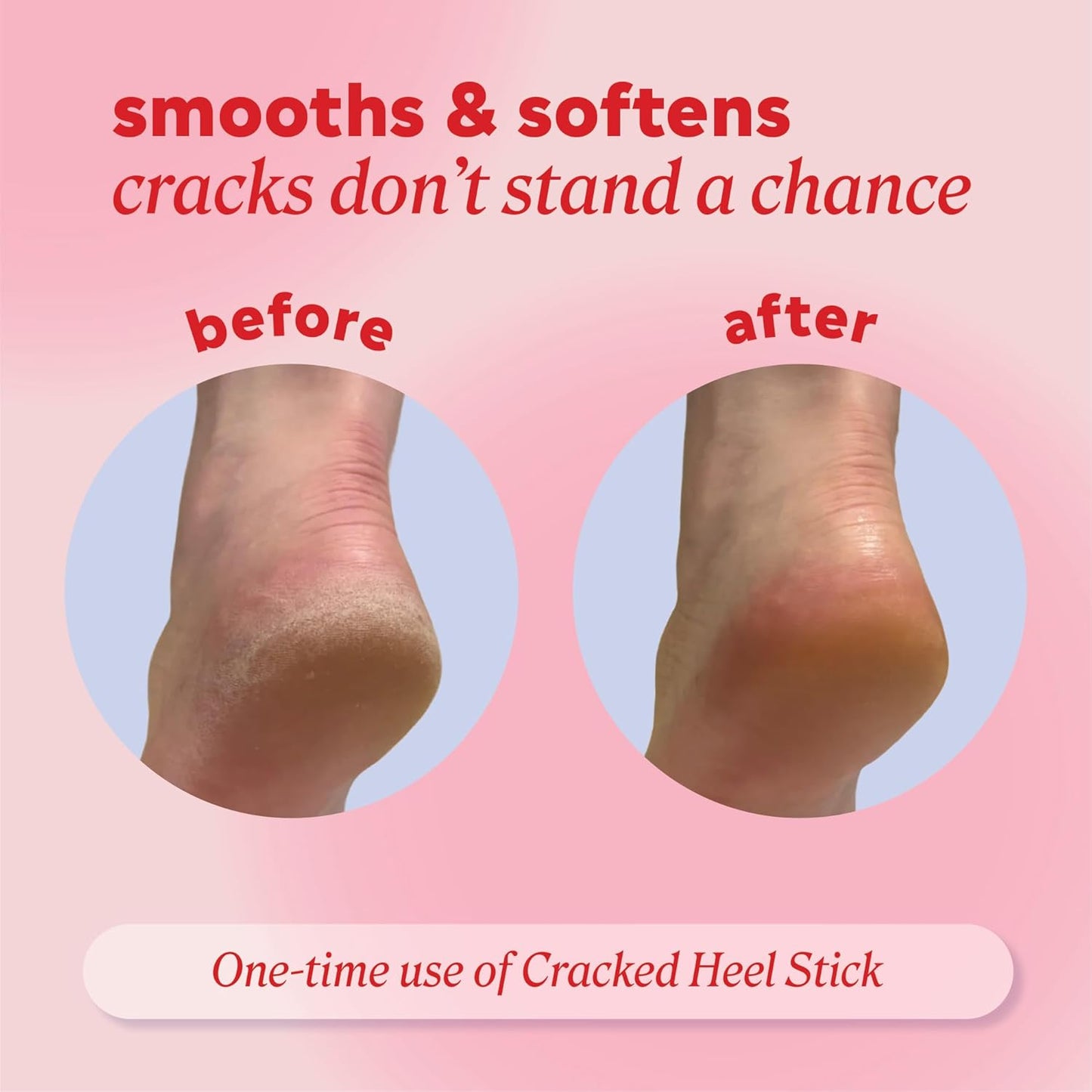 Onyx Professional Cracked Heel Repair Balm Stick for Dry Cracked Feet Treatment, Coconut Scent.. 1 pack