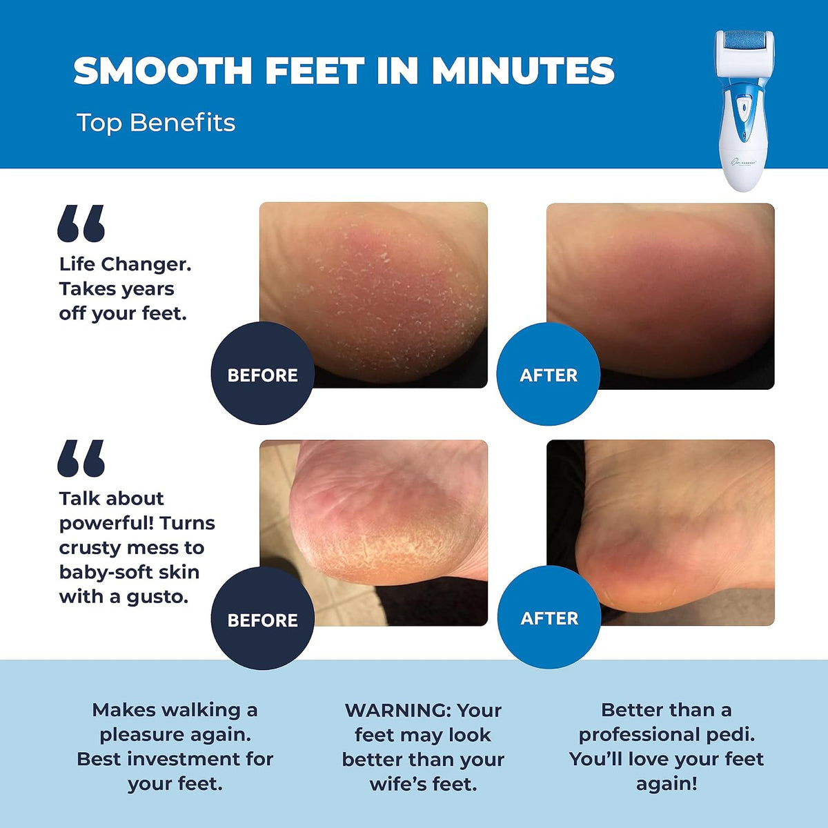 OwnHarmony Electric Foot Callus Remover - Rechargeable Pedicure File Tool
