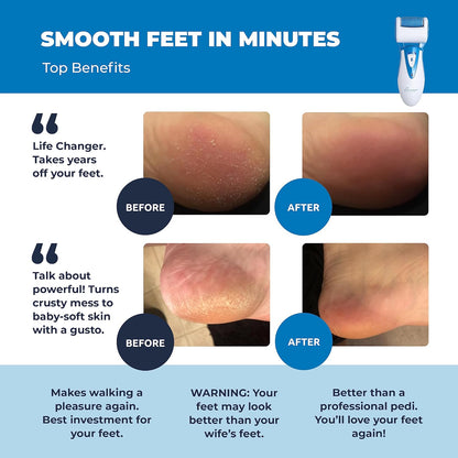 OwnHarmony Electric Foot Callus Remover - Rechargeable Pedicure File Tool