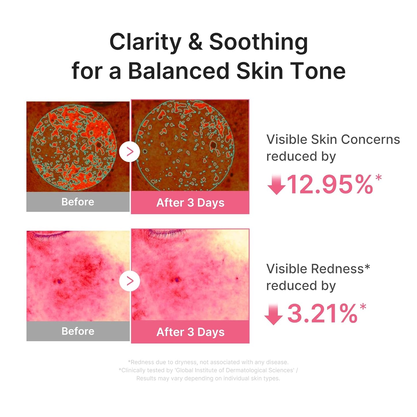 medicube PDRN Pink Peptide Serum with Salmon DNA | Ultra Light Hydrating Serum with Hyaluronic Acid..