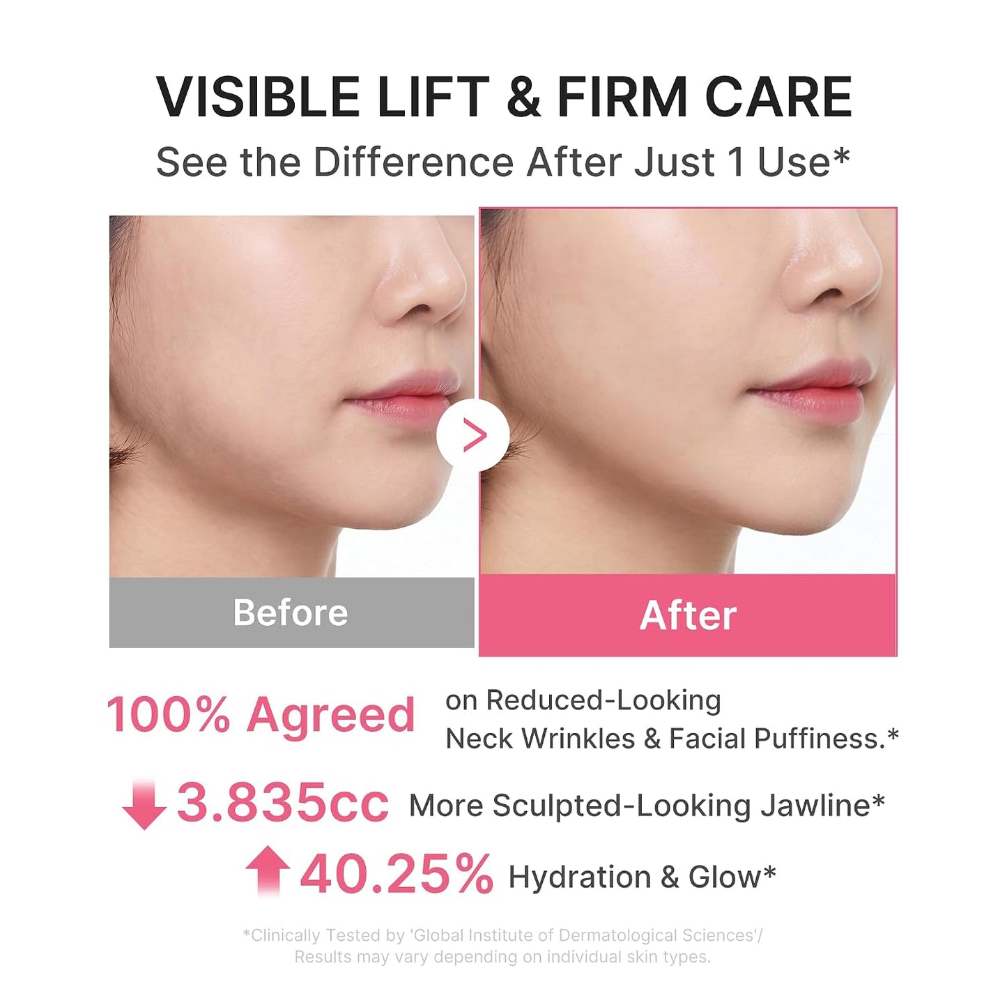 medicube PDRN Collagen Gua Sha Neck Wrinkle Cream | Built-In Gua Sha Massager with Volufiline 5% | Firming...