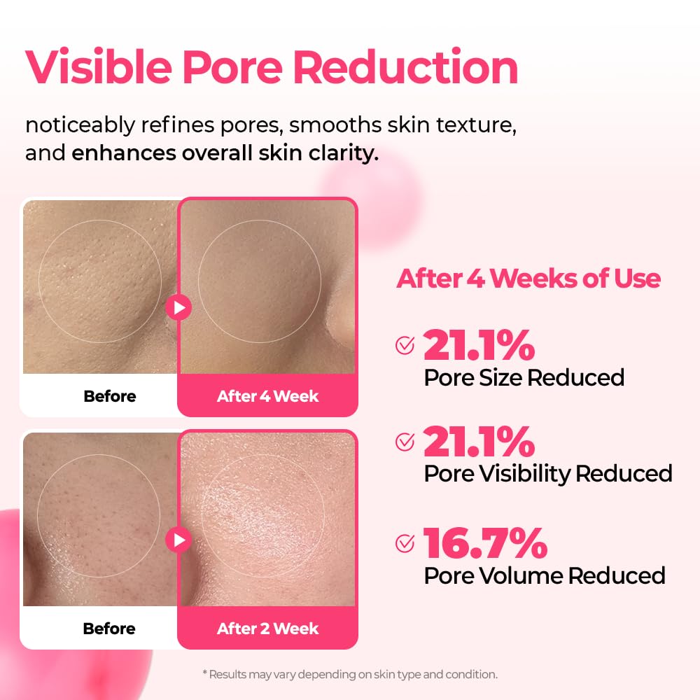 Dr.Melaxin Cyano Pink Spicule Serum with Vitamin B12, Liquid Microneedle Facial Treatment for Enlarged Pores..