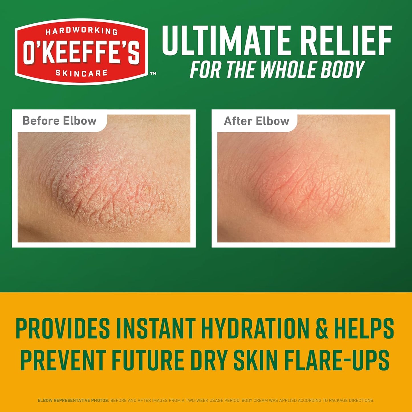 O'Keeffe's Skin Repair Ultimate Relief Body Cream, 7oz Tube | For Extreme Dryness, 48 Hours of Hydration, Contains Shea Butter..