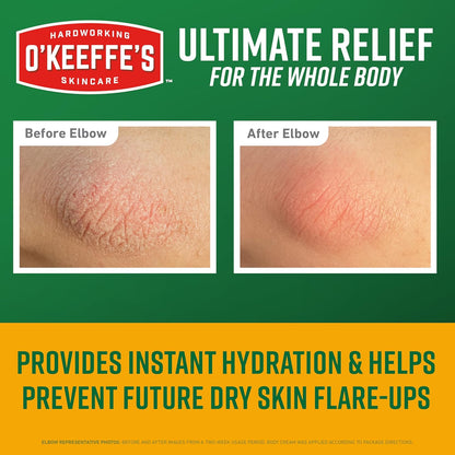 O'Keeffe's Skin Repair Ultimate Relief Body Cream, 7oz Tube | For Extreme Dryness, 48 Hours of Hydration, Contains Shea Butter..