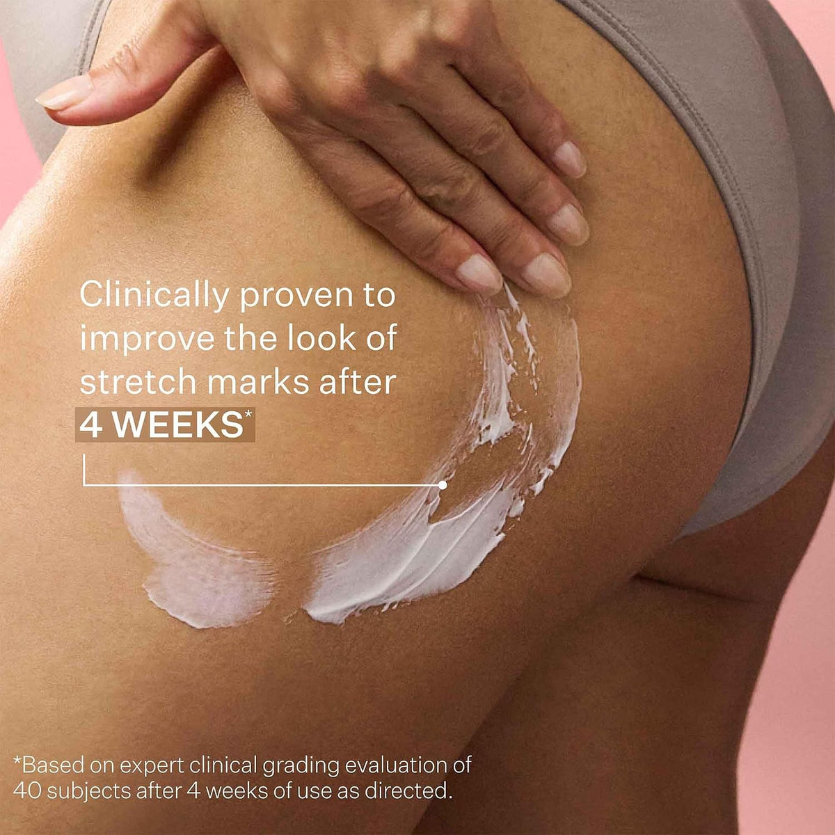 StriVectin SD Advanced Plus Intensive Moisturizer for Wrinkles and Stretchmarks
