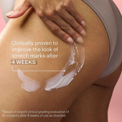 StriVectin SD Advanced Plus Intensive Moisturizer for Wrinkles and Stretchmarks