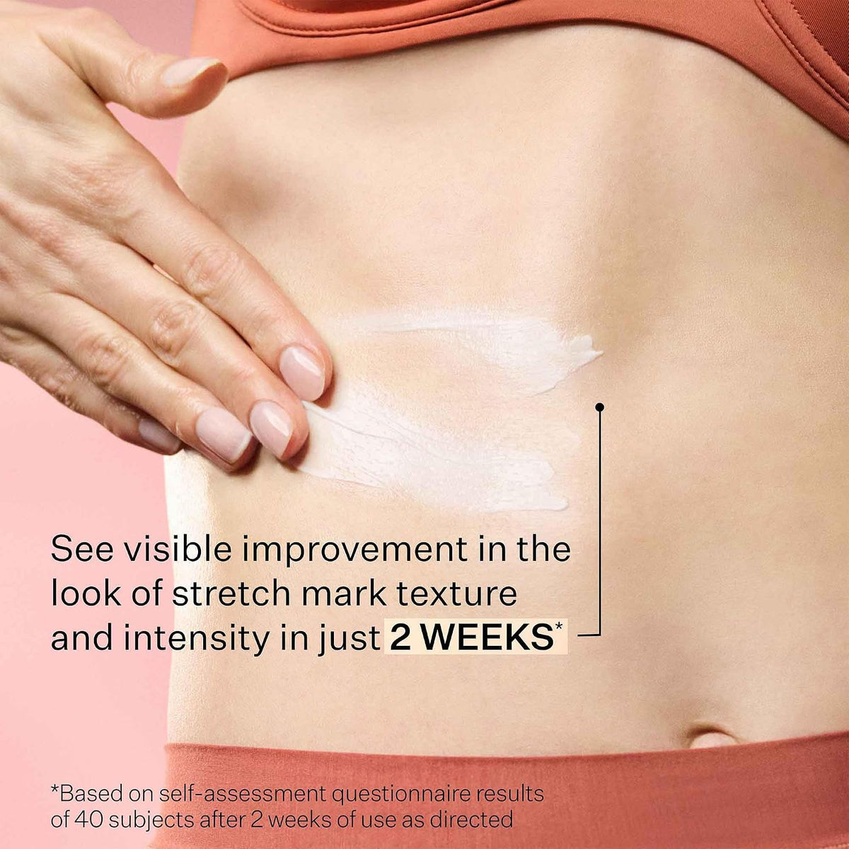StriVectin SD Advanced Plus Intensive Moisturizer for Wrinkles and Stretchmarks