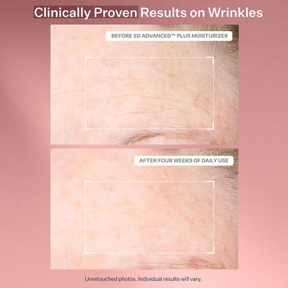 StriVectin SD Advanced Plus Intensive Moisturizer for Wrinkles and Stretchmarks