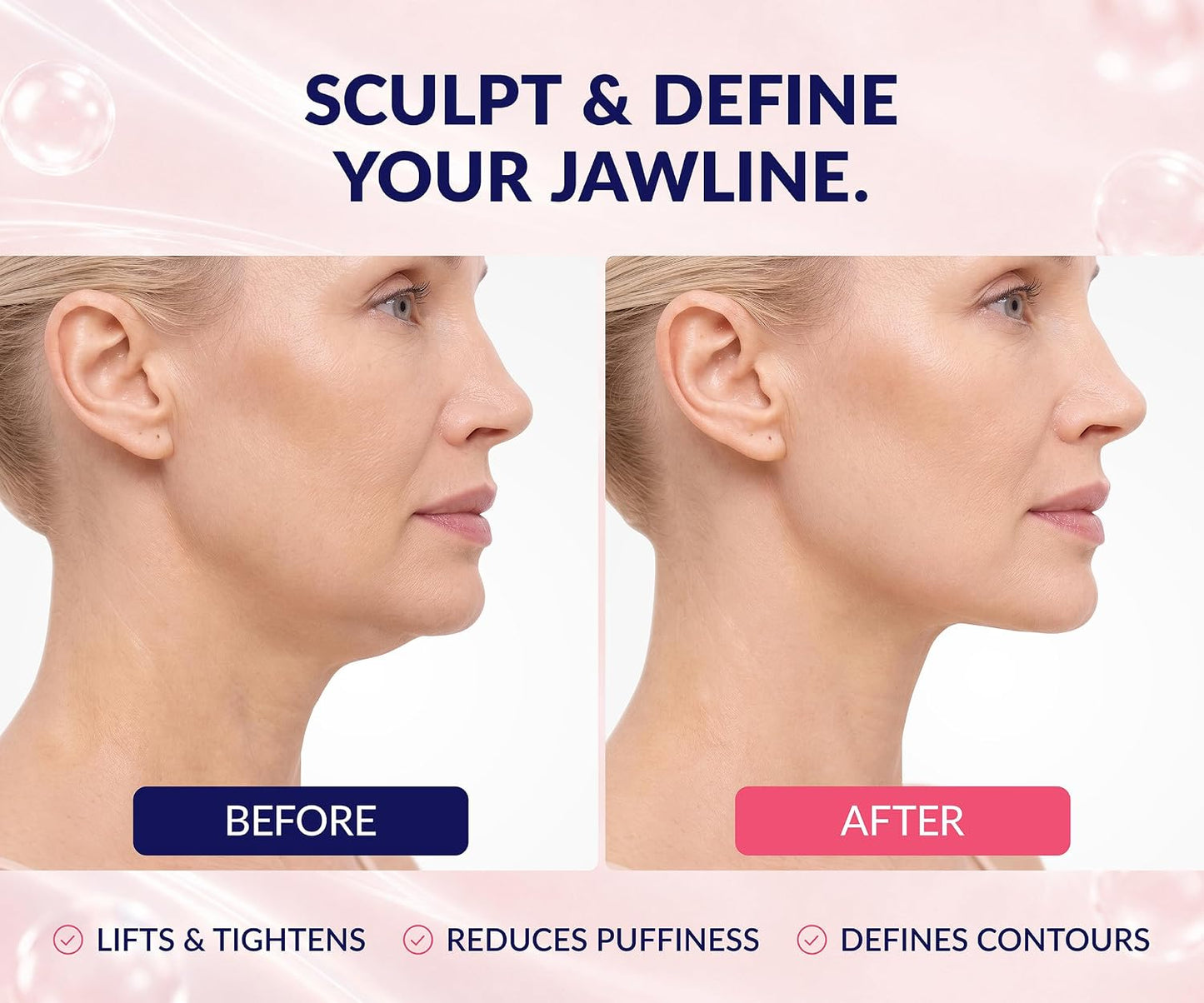 Stylia V Line Lifting Collagen Mask - Lift, Firm &amp; Contour Jawline - Tightening Double Chin Strap with Hyaluronic Acid & Aloe..