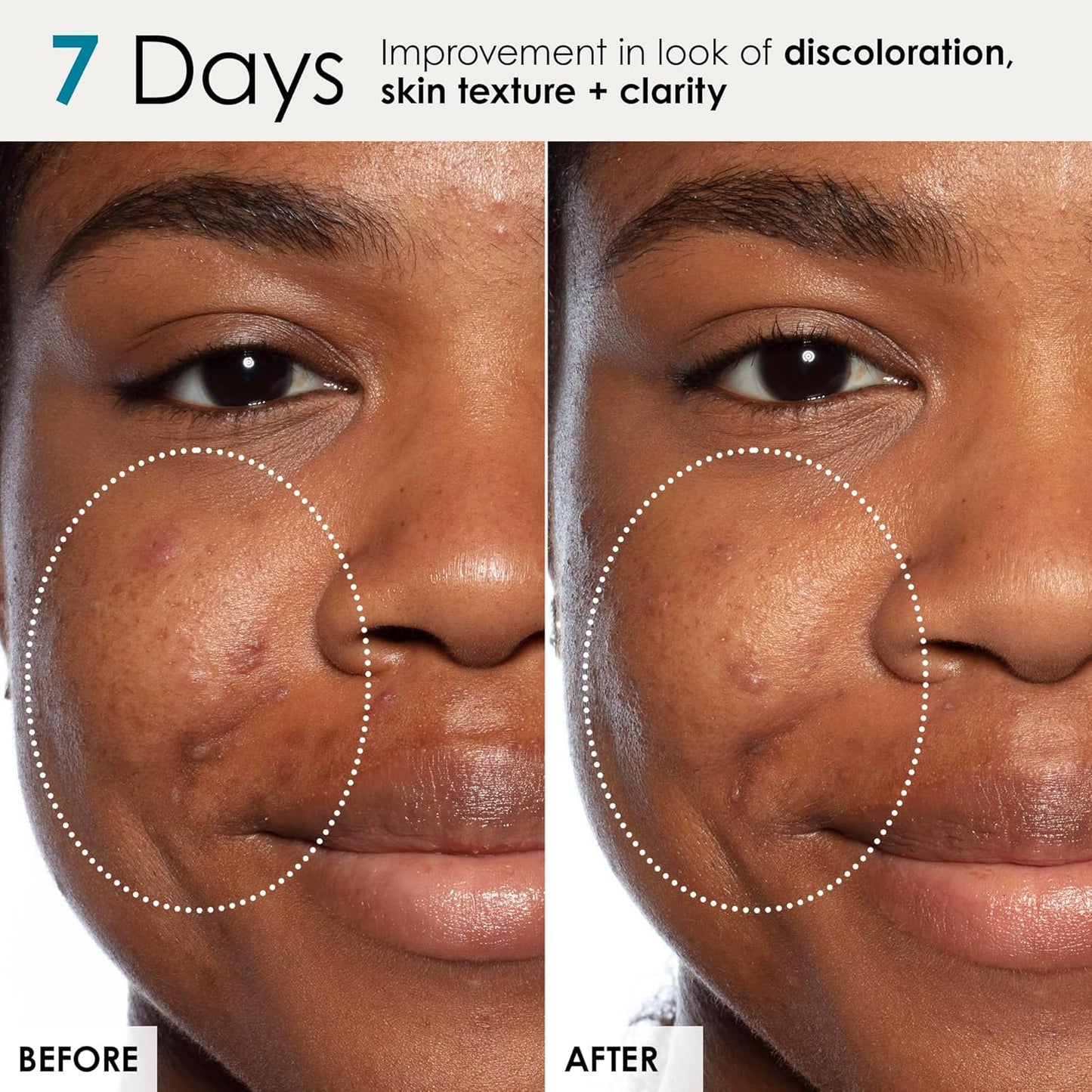 Sunday Riley Good Genes All-in-One Lactic Acid Treatment Face Serum