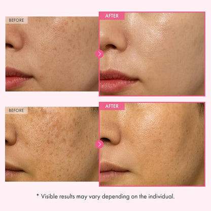 TOSOWOONG Arbutin 7% Glutathione Cream, 70,000ppm Arbutin + 5,001ppm Glutathione, Niacinamide, Dark Spots, Freckle, Blemishes..