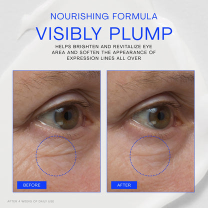 The Outset Vitamin C Eye Cream, Brightening, Hydrating &amp; Wrinkle-Reducing for Fine Lines &amp; Expression Wrinkles..