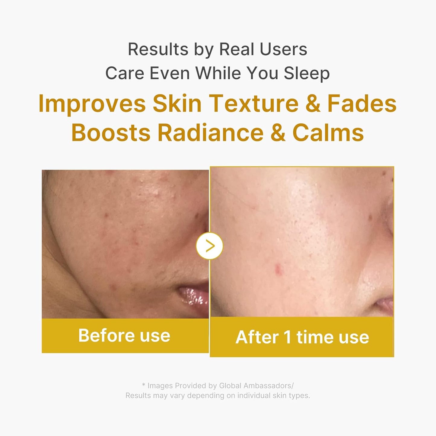 medicube Wrapping Mask Kojic Acid, Turmeric, Vitamin C Overnight Peel Off Facial Mask..