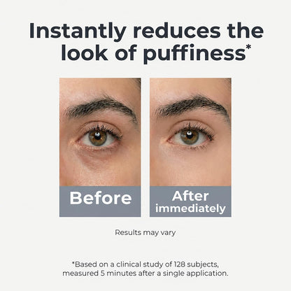 Under Eye Brightener Roller - Caffeine &amp; Retinol Eye Serum for Dark Circles, Puffiness & Fine Lines, Travel Essential Vegan Skincare..
