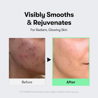 VT COSMETICS CICA Reedle Shot 300, Advanced Night Exosome, Microneedling Serum, Centella Asiatica, Hyaluronic Acid..