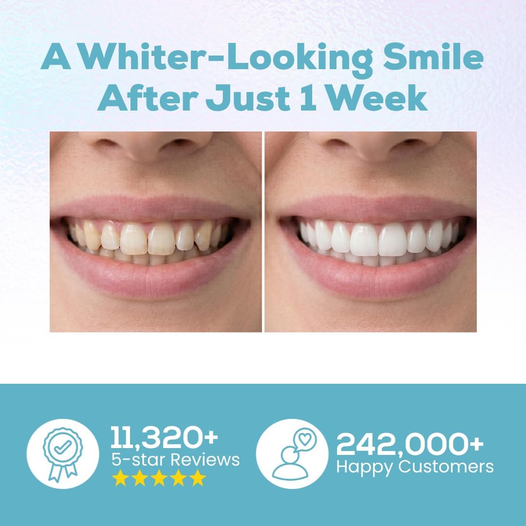 Venus Visage Teeth Whitening Pen (Pack of 2) – Professional Whitening Gel, 30+ Uses, Low Sensitivity..