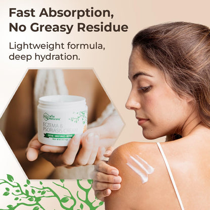 Wild Naturals Eczema & Psoriasis Cream for Dry, Itchy Skin – Eczema Relief