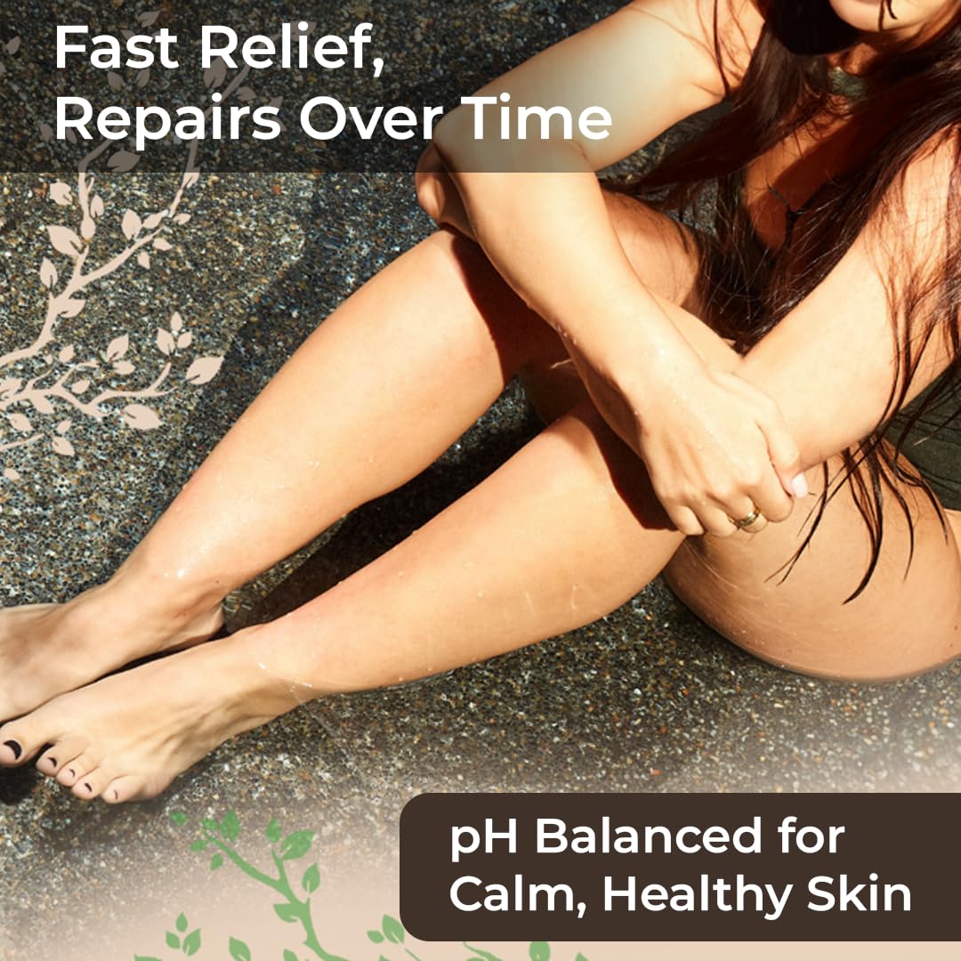 Wild Naturals Eczema & Psoriasis Cream for Dry, Itchy Skin – Eczema Relief