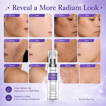 Dark Spot Remover for Face & Body, Brightening Serum with Vitamin C & Hyaluronic Acid | 1.70 FL OZ (Pack of 1)