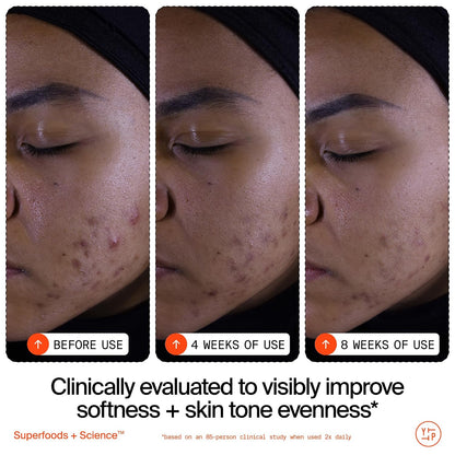 Youth To The People Superfruit Cleanser - Gentle Exfoliating Face Wash