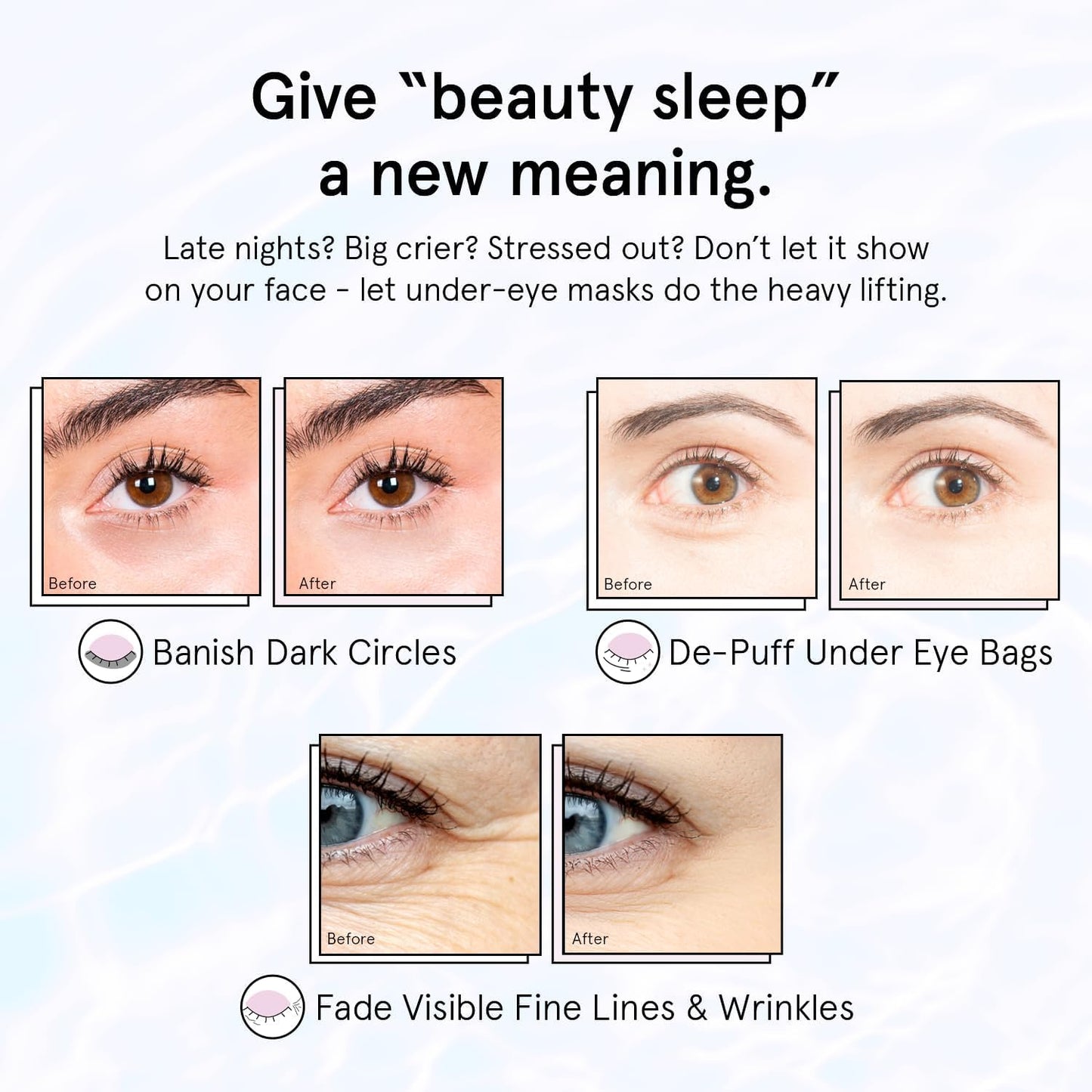 grace &amp; stella Retinol Under Eye Patches for Puffy Eyes &amp; Dark Circles - Restoring Gel Under Eye Masks with Hyaluronic Acid