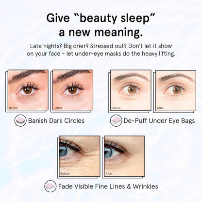 grace &amp; stella Retinol Under Eye Patches for Puffy Eyes &amp; Dark Circles - Restoring Gel Under Eye Masks with Hyaluronic Acid