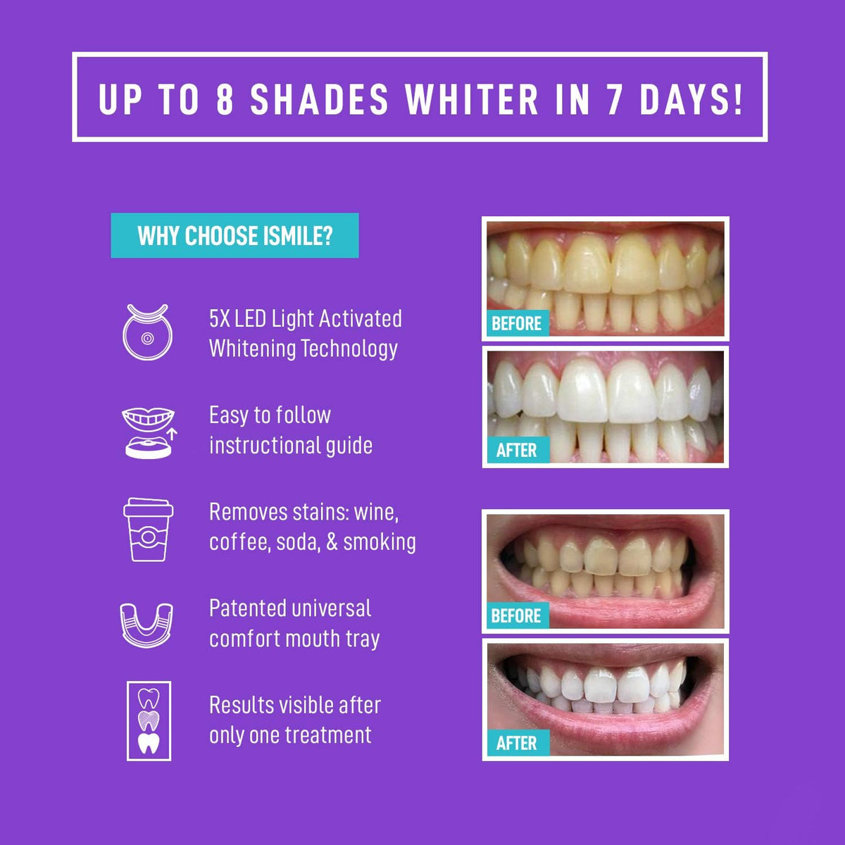 iSmile Teeth Whitening Kit - LED Light, 35% Carbamide Peroxide