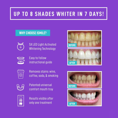 iSmile Teeth Whitening Kit - LED Light, 35% Carbamide Peroxide