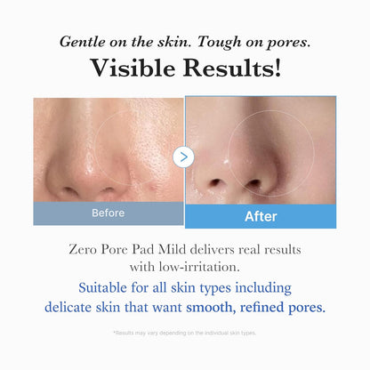 medicube Toner Pads Zero Pore Pad 2.0  | Gentle Calming Toner Pad for Exfoliation, Minimizing Pores &amp; Blackhead Removal with PHA ..