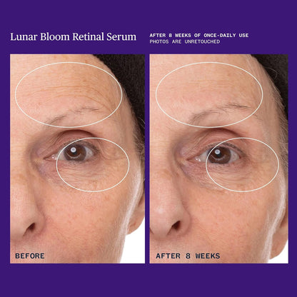 Ursa Major Lunar Bloom Retinal Serum | Potent & Gentle Facial Moisturizer | Smooth Fine Lines & Wrinkles ..