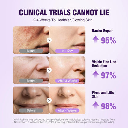 Retinol Peptide Serum for Face & Neck with NAD+ Support,Firming Collagen Skin Care for Fine Lines..